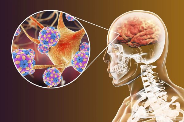 Diverse States Of Awareness, Brain Function And The Formation Of Reality Diverse States Of Awareness, Brain Function And The Formation Of Reality