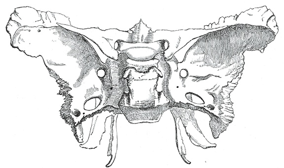 Sphenoid Bone Sphenoid Bone