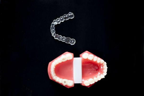 7 Reasons Why You Might Need Dental Night Guards 7 Reasons Why You Might Need Dental Night Guards