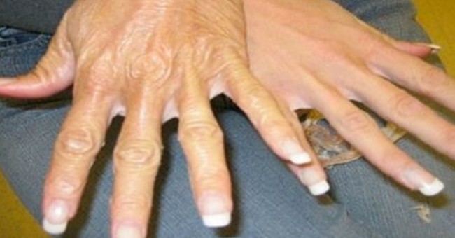 Amazing Recipe To Stop Your Hands From Revealing Your Age! /amazing-recipe-to-stop-your-hands-from-revealing-your-age