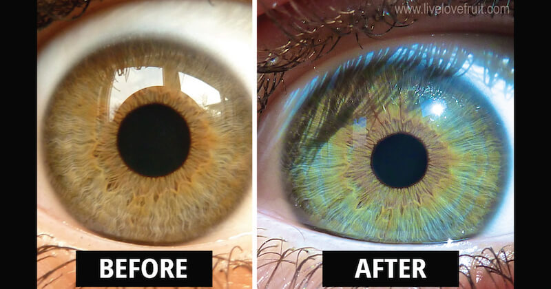 My Eyes Changed Colour After Eating Raw Vegan For 6 Years eyeschangecolour