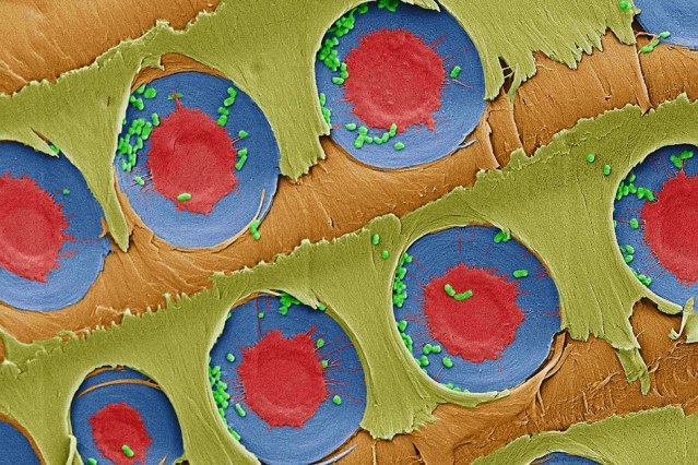 A false-color electron microscope image showing E. coli bacteria (green) trapped over xylem pit membranes (red and blue) in the sapwood after filtration. Image courtesy of the researchers tree-bark