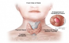 Hypothyroidism and Essential Oils: Natural Remedies Ignored by Mainstream Medicine