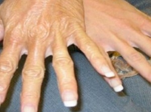 Amazing Recipe To Stop Your Hands From Revealing Your Age!