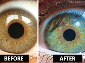 My Eyes Changed Colour After Eating Raw Vegan For 6 Years