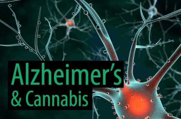 alzheimer