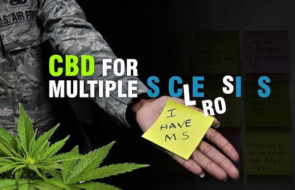 Might Help in Treating Multiple Sclerosis Might Help in Treating Multiple Sclerosis