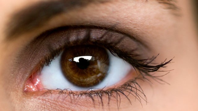 Cataracts cataracts