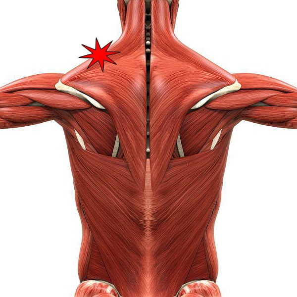 Fascia Pain fascia-pain