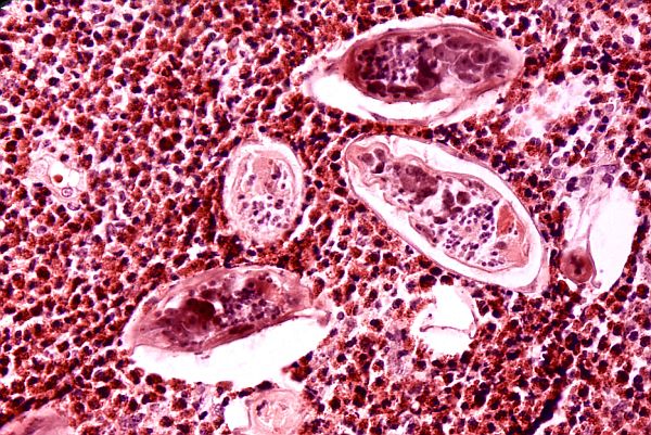 Clean Your Body From Parasites And Return To Your Normal Weight With These 2 Ingredients That You Always Have In Your House! parasites