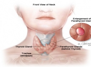 Hypothyroidism and Essential Oils: Natural Remedies Ignored by Mainstream Medicine