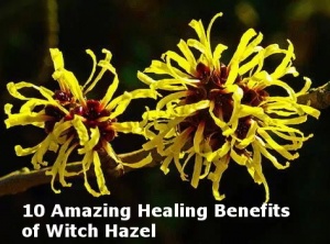 10 Amazing Healing Benefits of Witch Hazel