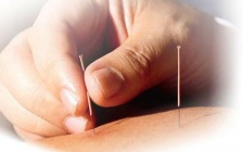 Acupuncture - A Primer